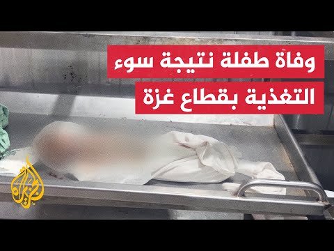 فيديو | وزارة الصحة في غزة: ارتفاع عدد شهداء سوء التغذية إلى 447 بينهم 147 طفلا