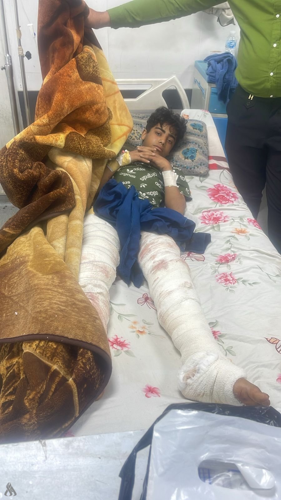 الصحة تعلن معالجة الطفل الذي تعرض لهجوم نمر بحديقة حيوانات الزوراء